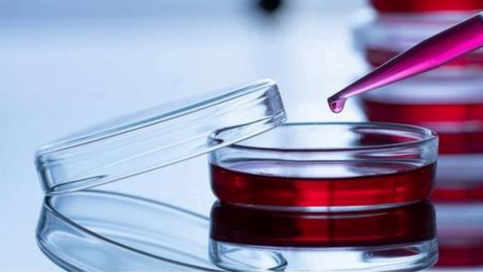 THE NEED FOR MICROBIOLOGY (1)